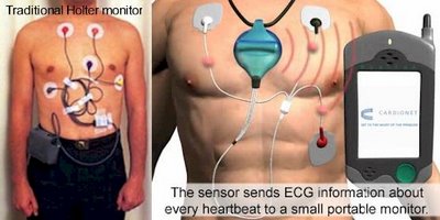Holter Monitor